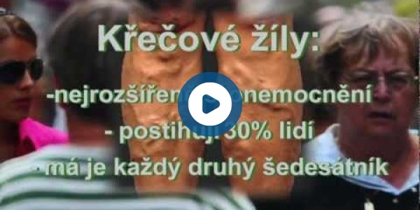  Videoreportáž byla natočena ve spolupráci s firmou Covidien.